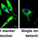 Weibo Cai and colleagues at the University of Wisconsin-Madison have developed a technique that detects a pair of markers for glioblastoma, a type of brain cancer. Left: Cancerous cell is marked with green (blue shows cell nucleus but does not indicate cancer). Right: When only one marker, called epidermal growth factor receptor, is detected in the same sample, the cancer signal is much less obvious. Credit: Weibo Cai lab, University of Wisconsin-Madison