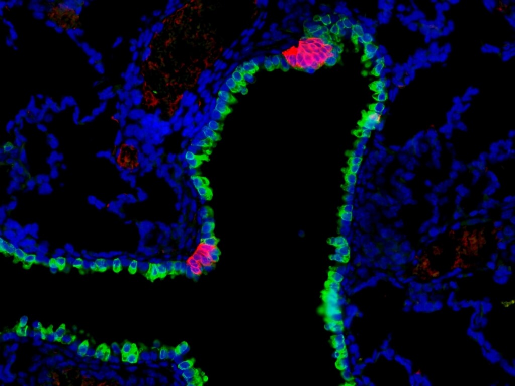 Pulmonary neuroendocrine cells (red) are rare cells found in clusters along the mammalian airway, where they act as sensors, sending information to the central nervous system. These clusters are found interspersed among other airway epithelial cells (green). The cells, whose function was previously unknown, have been found by a group led by medical geneticist Xin Sun to sense environmental stimuli and report to the nervous system to orchestrate an immune response. 