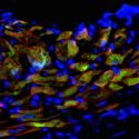 Induced cardiac progenitor cells (iCPCs) injected into hearts of mice with experimentally induced heart attacks generate new heart muscle. Newly developed heart muscle cells are shown by overlapping red (heart muscle protein) and green (iCPC protein) labeling, and cell nuclei are shown in blue. 