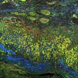 Human tissue and blood vessels look like the Water Lilies painting by Monet.