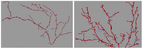 Photo: Mouse neurons with and without human AT-1