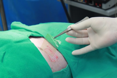 Photo: Microlyte being injected into a pig