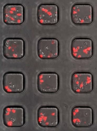 Photo: Cancer cells in sample wells turn red when killed by the T-cells engineered to include the chimeric antigen receptor. 