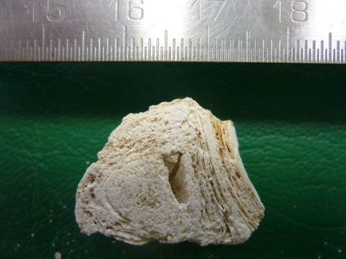 Photo: Cross section of the calcified nodule