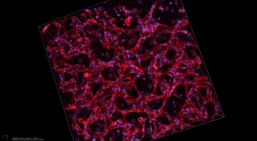 A 3-dimensional image of a network of human blood vessels formed within a hydrogel created by Stem Pharm Inc. The red stain shows endothelial cells organized into vessels; the blue stain shows the nucleus of each cell. (Image courtesy Stem Pharm) 