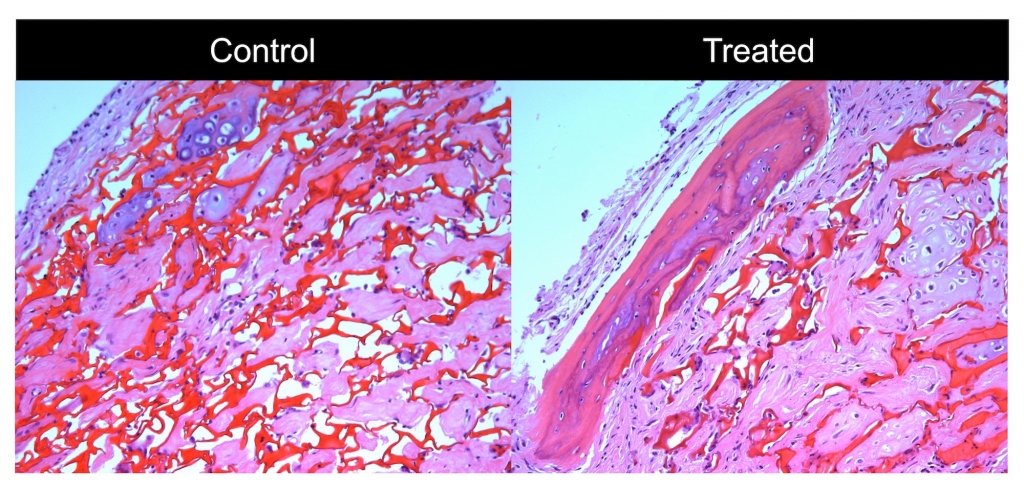 Photo: Bone cells in a mouse model