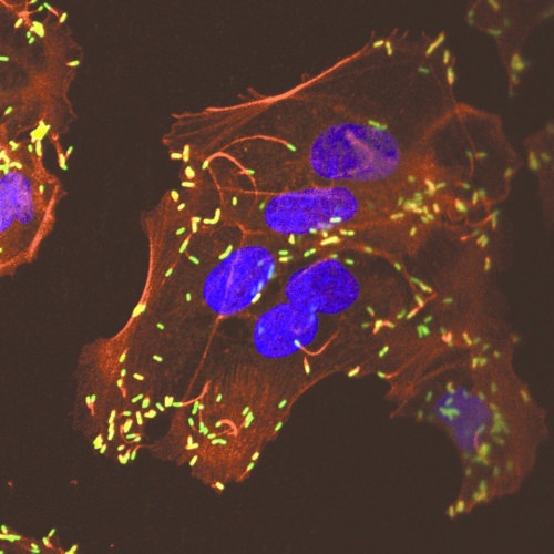 Photo: Listeria, stained green, invading uterine cells in monkey