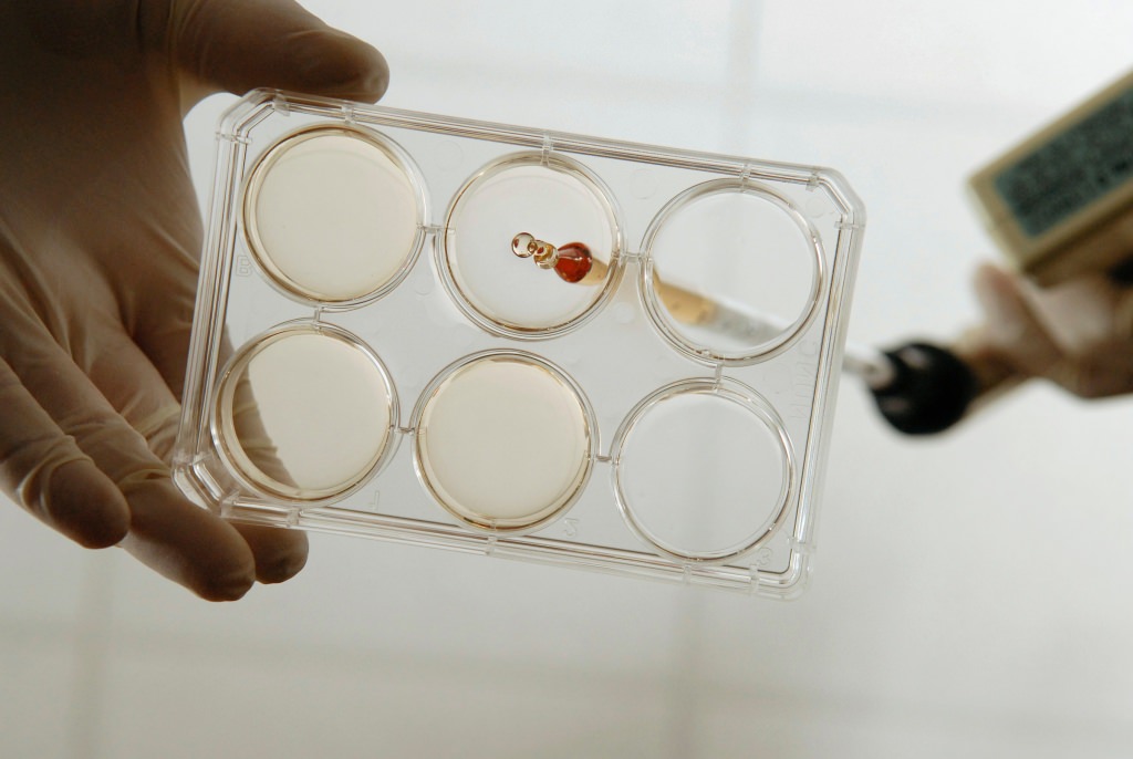 Photo: Closeup of researcher with stem cells