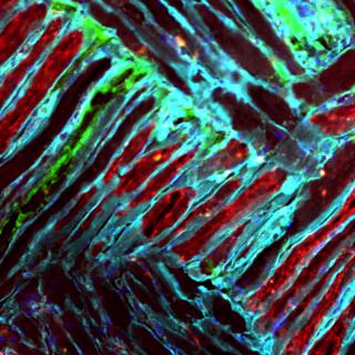 This image depicts the fibers (outlined in light blue) of muscles that are interwoven, like a basket, in the core of the tongue. This intricate muscular anatomy contributes to the tongue’s unique ability to move in the many different ways necessary for tasks such as swallowing and speech. Images like these help researchers study changes in ageing muscles that could contribute to swallowing disorders. Miranda Cullins, postdoctoral researcher, Connor Lab, Department of Surgery | epifluorescent microscope