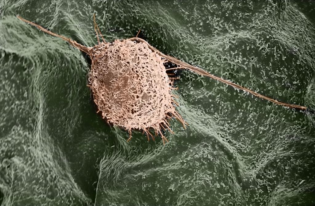 Photo: A human fibroblast cell finds a home on a lilac leaf