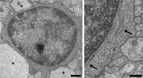 In the mutant spinal cord, the oligodendrocyte, a cell that makes myelin, is surrounded by conductive fibers (called axons, marked with *) that lack myelin sheaths. On higher magnification, this cell has a huge increase in microtubules (arrows) that fill the cytoplasm and line up with cell membranes. 