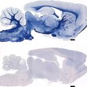 A normal 9-month-old rat has myelin (blue) throughout the brain but the age-matched mutant rat (below) appears to have none. (Scale bar is 1 mm; front of brain is at right.)
