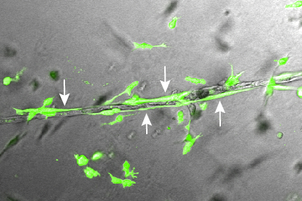 Close-up View depicting tubular structure formed by cells closely associated with mural cells, cells that underpin human vasculature. A team from the University of Wisconsin School of Medicine and public Health and the Wisconsin National Primate Research Center have coaxed stem cells to become the cells that make up human veins, arteries and capillaries. 