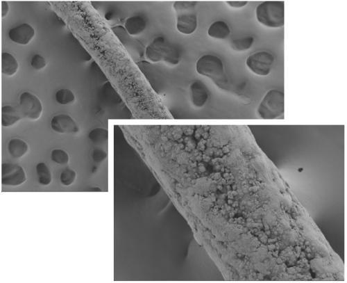 Photos: A surgical suture coated with a mineral that mimics bone