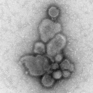 Photo: Influenza A H7N9 as viewed through an electron microscope.