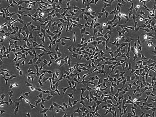 Photo: Mesenchymal cells