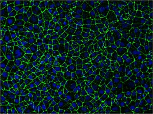 Photo: Microscopic image of Stem-cell-derived endothelial cells