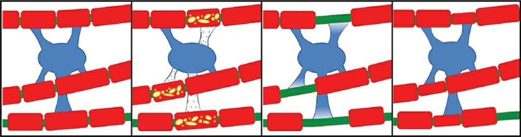 Graphic: Drawing of nerve cell extensions called axons 