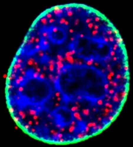 Photo: Micrograph of p53 protein