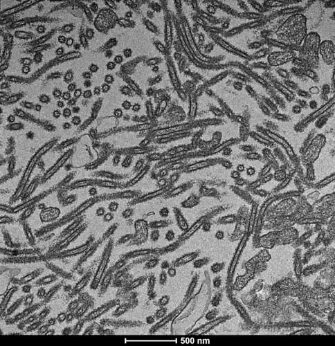 Photo: Image of H3N2 viruses.