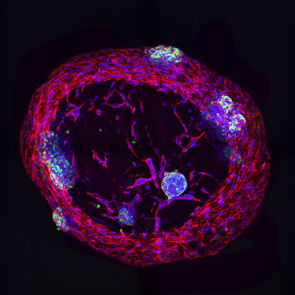 Photo: insulin-producing cells growing in a gel designed to keep them healthy for transplant into diabetes patients