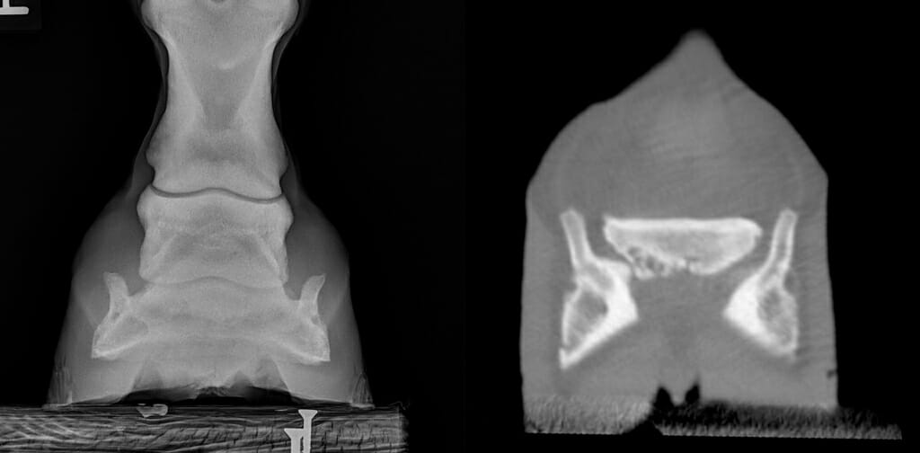 Photo: Two x-ray images.