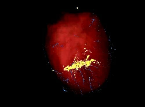 Photo: A needle track across a pig heart.