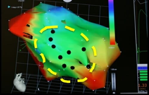 Photo: A diagram showing a heart