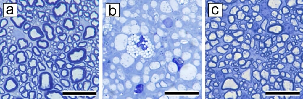 Three panels that show a close-up of axons in the optic nerve.