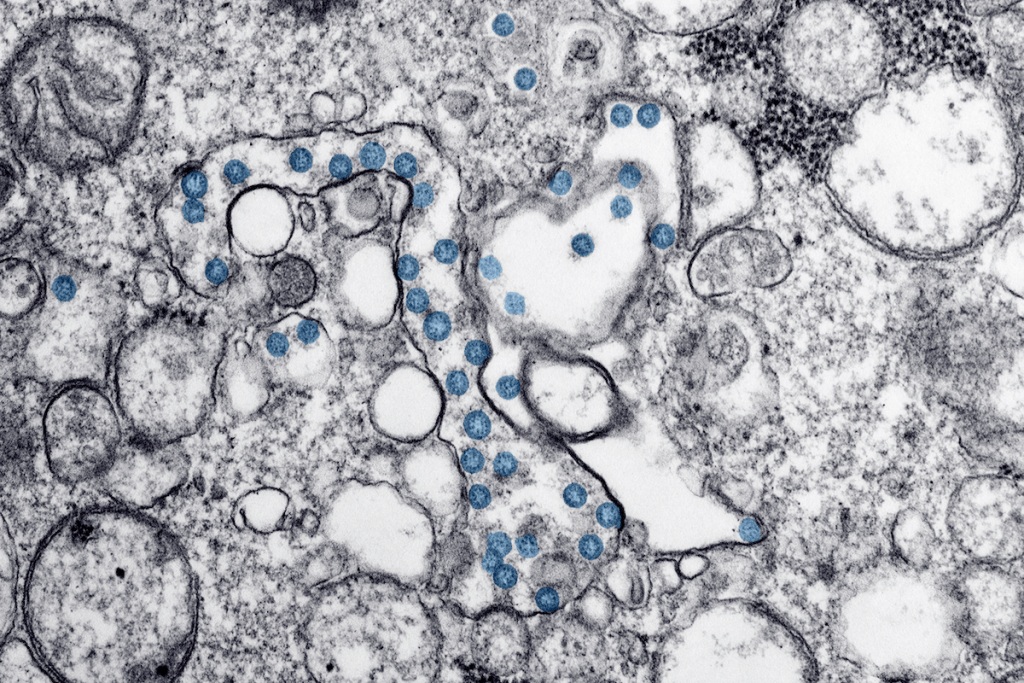 Micrograph of COVID-19 viral particles