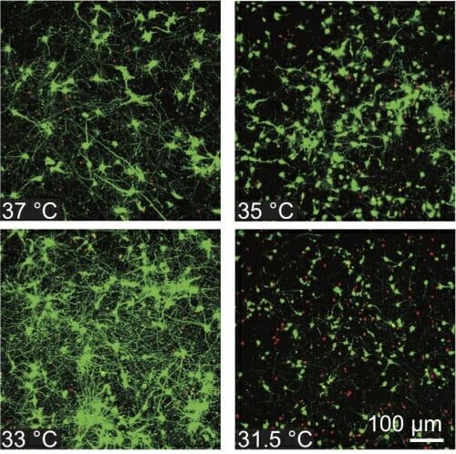 Healthy cells appear green and dead cells red after a concussion-causing impact and temperature-lowering treatment.