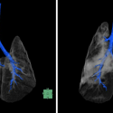 X-rays of hamster lungs