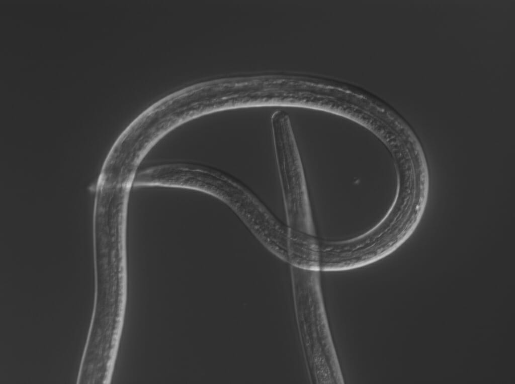 Microscopic image of nematode