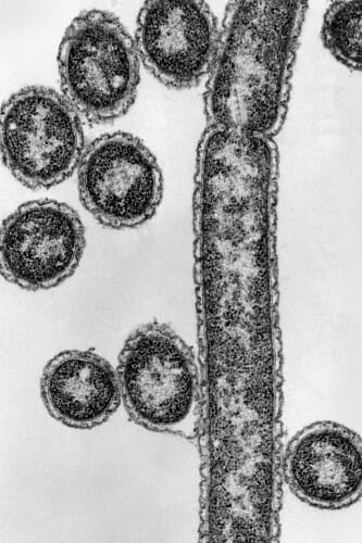 Thermus aquaticus microscopic image