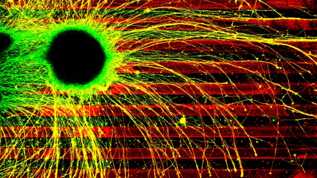 Axons in the brain