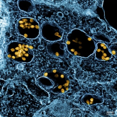 A color-enhanced electron micrograph of SHFV growing in cell culture.