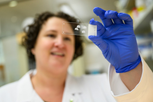 Wearing a white lab coat and blue gloves, Kirstan Gimse holds up a glass slide with tissue samples.