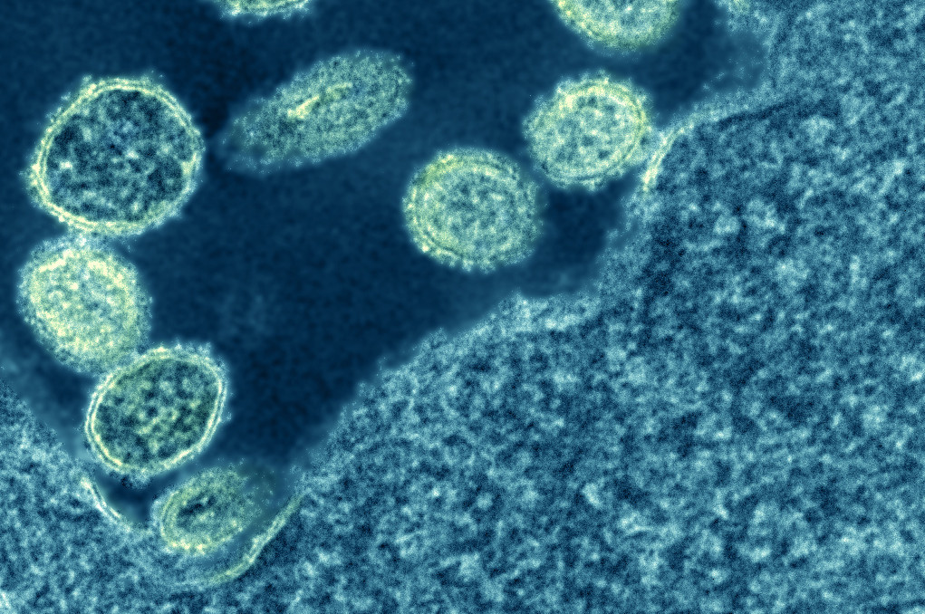 A group of about a dozen roughly circular virus particles swarm around the edge of a much larger cell that is only partially in view.