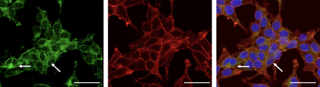 Three side-by-side microscope images of retina cells dyed green, red and blue.