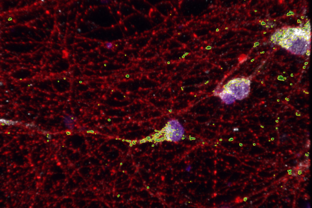 A dense spiderweb-like network of red lines punctuated by glowing spots of green and purple.