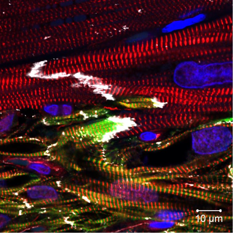 A view through a microscope of human heart cells appears as an abstract collage of bright red, blue, green and yellow lines and swirls.