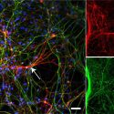 Three microscope images show branching filaments of brain cells stained green and red crisscrossing against a black background. A white arrow near the center of the left image indicates the body of a norepinephrine neuron, the subject of the study.