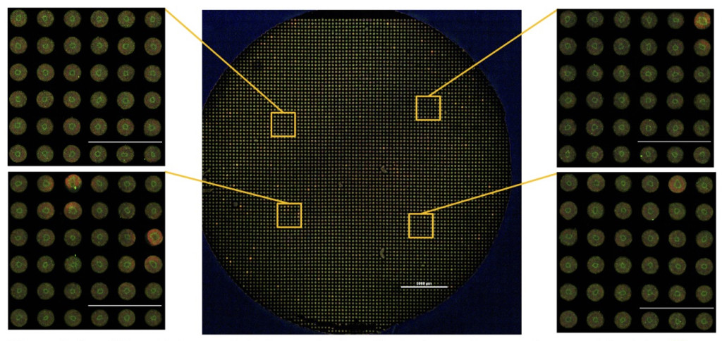 An image taken from a scientific paper shows four pictures of small clusters of neural cells, called rosettes, that look like yellow donuts with green centers. A fifth photo shows that the four peripheral images have been enlarged from an even larger collection of rosettes.