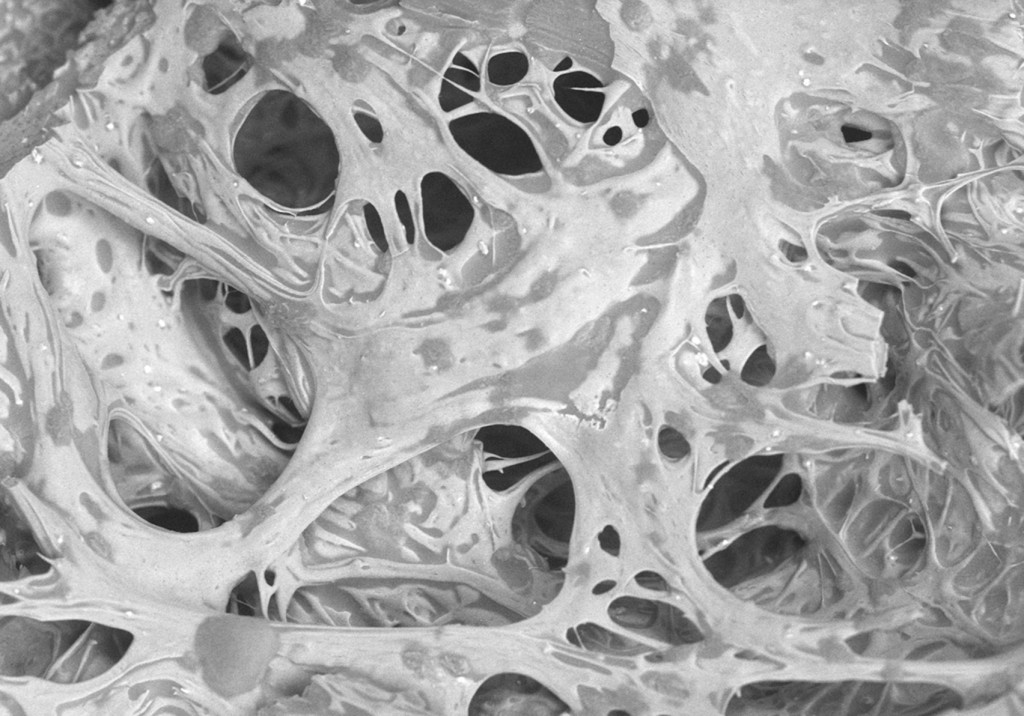 A black and white image of fibers stretching and growing.